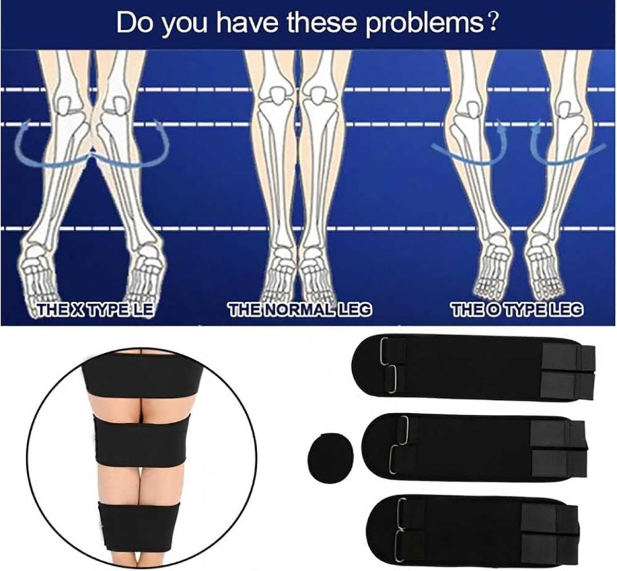 X/O Shape Leg Correction Belt – Adjustable Leg Alignment & Posture Support Brace for Adults - Image 2